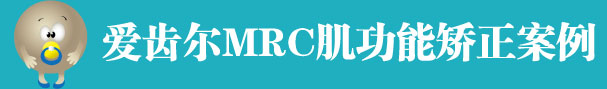 牙博士MRC肌功能训练儿童矫正案例